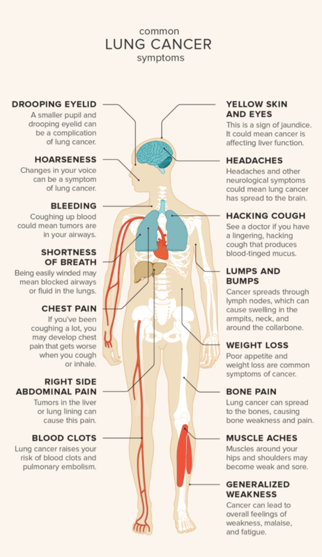 lung cancer symptoms