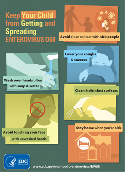 enterovirus
